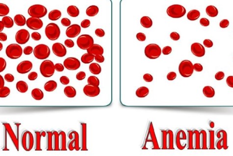 Anemia
