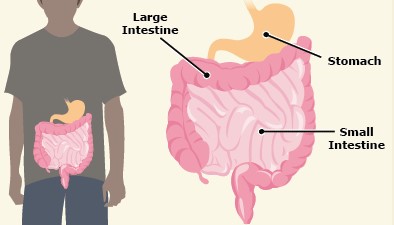 malattie intestinali