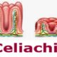 celiachia