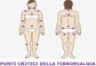 fibromialgia punti dolore