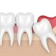 denti del giudizio