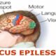 formazione per gestire l'epilessia