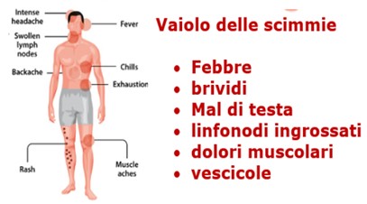 vaiolo delle scimmie