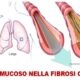 fibrosi cistica