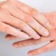 dermatite atopica
