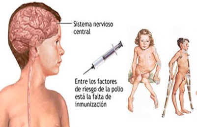 vaccino antipolio