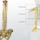cura per la spina bifida