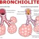 nuove linee guida bronchiolite