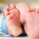 screening neonatale