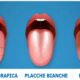 malattie della lingua