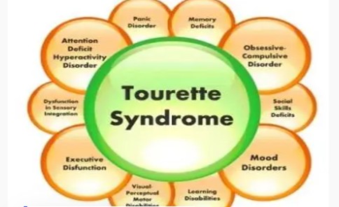 Sindrome Di Tourette Un Viaggio Nella Neurologia Guida Genitori Sindrome Di Tourette Un Viaggio Nella Neurologia Guida Genitori